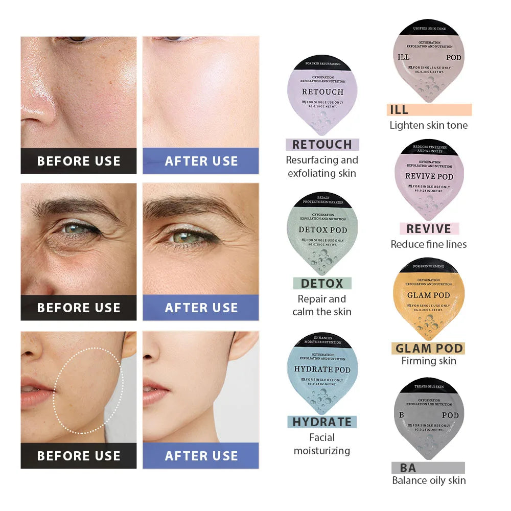 Lot de 5 capsules CO₂ pour stylo à bulles – Nettoyage aqua du visage – Soin spa oxygénant