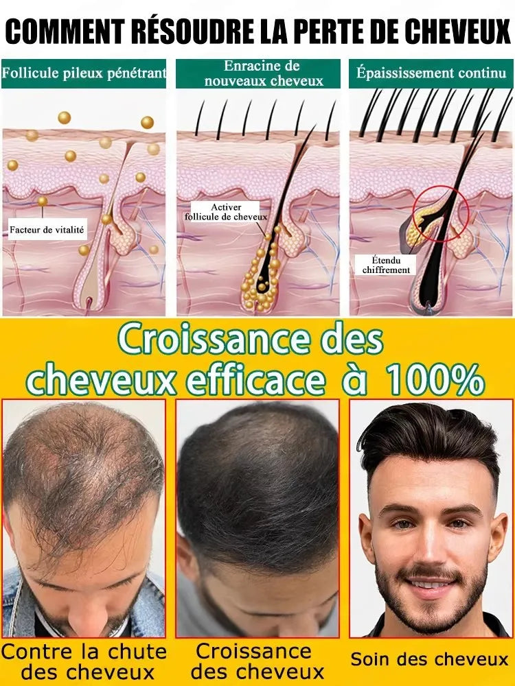 Applicateur & masseur pour cuir chevelu – Peigne distributeur de liquide – Outil massage pour croissance des cheveux